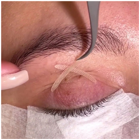 Double-Sided Eyelid Tape (300 pairs)