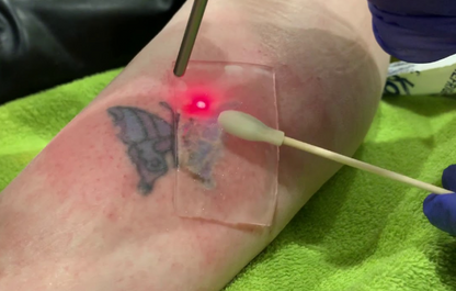Folia PFD pach pentru indepartare tatuaje cu laser, Silicon Pach Folia Magica tattoo removal
