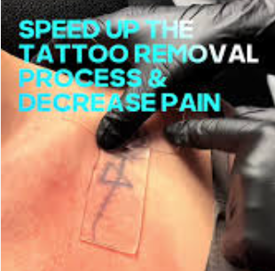 Folia PFD pach pentru indepartare tatuaje cu laser, Silicon Pach Folia Magica tattoo removal